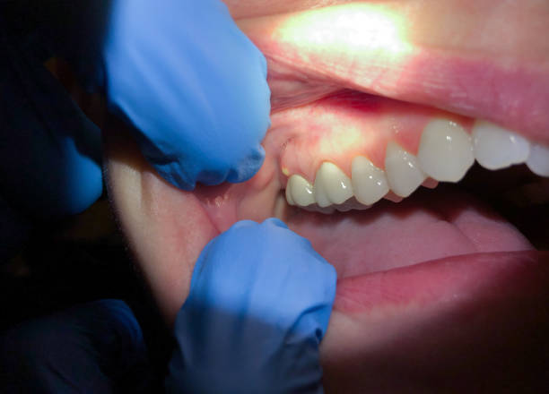 Best Same-Day Emergency Dental Services in Toftrees, PA