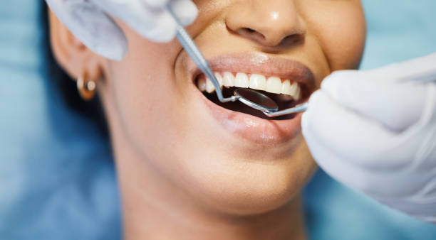 Best Emergency Dental Care for Broken or Chipped Teeth in Toftrees, PA